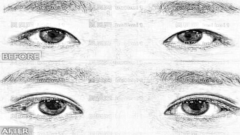郑州善雅整形怎么样?全切双眼皮价格贵吗?果自然吗?