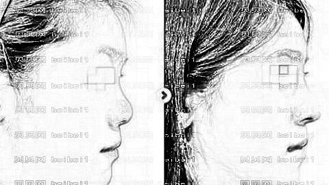 石家庄星源隆鼻怎么样?价格贵吗?哪个医生做得好?