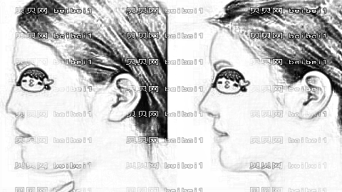 天津欧菲隆鼻大概多少钱？哪个医生做妈生鼻技术好？