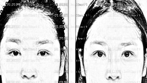 天津维美隆鼻哪个医生技术靠谱?李文祥鼻部手术价格贵吗?