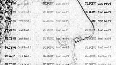 南宁做鼻子医生哪个做得好?南宁做鼻子较好的医生排名名单
