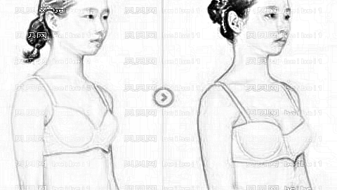 郑州悦美整形隆胸哪个医生技术好？恢复果超自然!