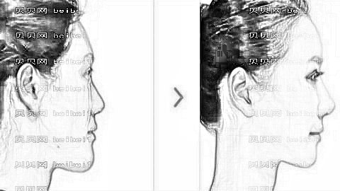 北京龙泽日盛医疗美容整形技术怎么样？,整形