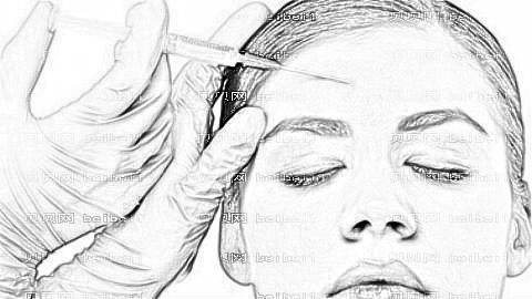 北京美莱宋延刚脂肪填充怎么样?面部自体脂肪填充多少钱?