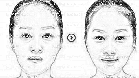 整形医院怎么样?靠谱吗?,整形