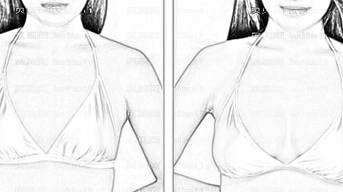 北京圣嘉荣隆胸哪个医生做得好?李石隆胸大概多少钱?