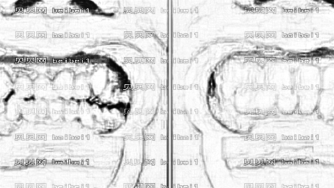 北京海德堡口腔医院正畸技术怎么样?