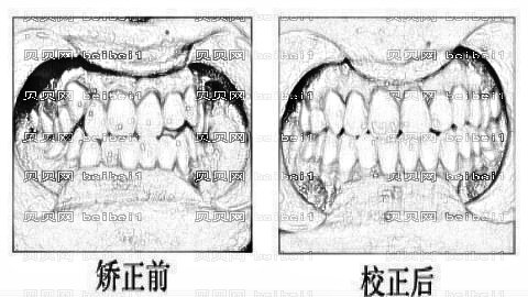 成都圣贝牙科怎么样?,正畸曝光!哪个医生技术好