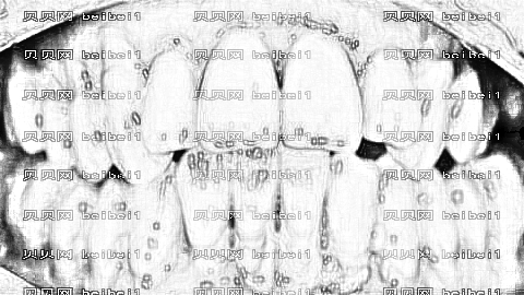 重庆韩佳牙博士口腔医院怎么样?,正畸曝光!