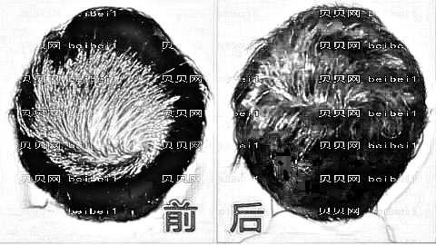 重庆雍禾植发怎么样?哪个医生技术好