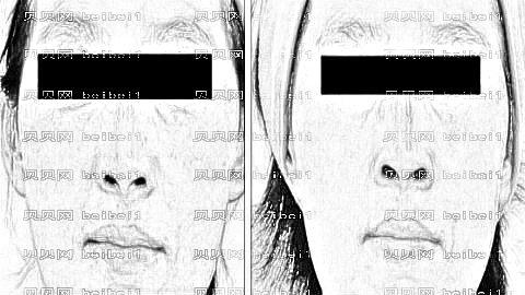 北京一美整形医院怎么样？哪个医生技术好？,整形