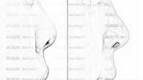 北京卓新华星整形口碑怎么样？哪个医生技术好？,整形