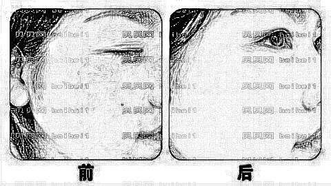 潍坊天宏整形医院怎么样?医生团队+整形价格