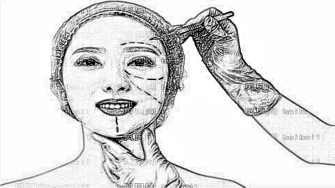 淄博美联臣整形医院怎么样?医生团队+整形价格