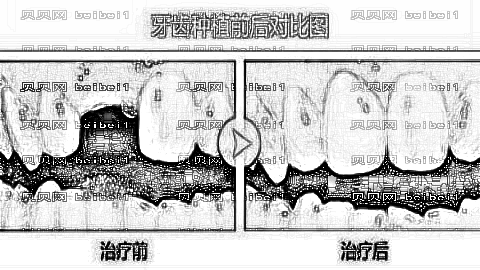 青岛可恩口腔医院怎么样?哪个医生技术好