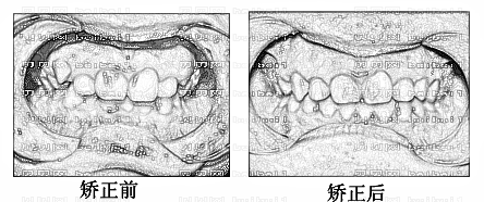 青岛优诺博士口腔医院怎么样？医生技术排名