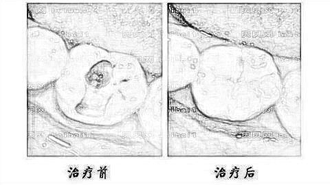 济南拜博口腔医院怎么样？哪个医生技术好