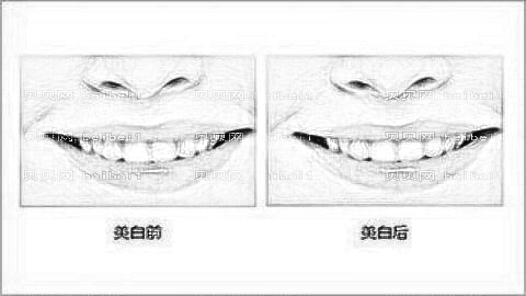 成都格林口腔怎么样?,正畸曝光!哪个医生技术好