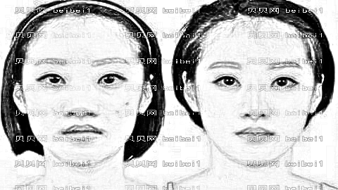 解放军第九六〇医院整形技术怎么样?,内部曝光