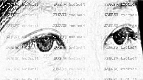 深圳美莱医院做双眼皮怎么样?深圳美莱整形医院靠谱吗?附介绍