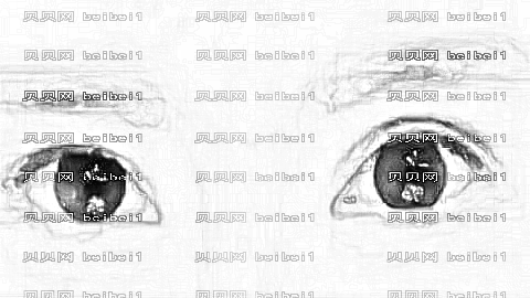 郑州美莱张芳做双眼皮怎么样?做双眼皮手术介绍,医院较为好!