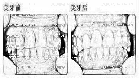 青岛瑞泰口腔医院怎么样?哪个医生技术好