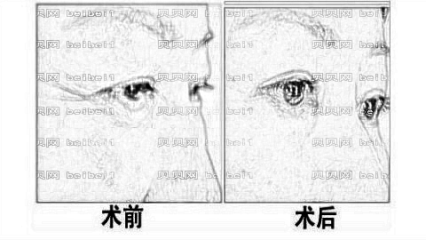 济宁壹美整形医院怎么样?医生团队+整形价格