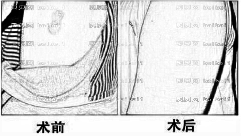曲靖美莱整形医院怎么样?医生团队+整形价格