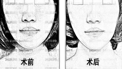 北京黛美整形医院怎么样?哪个医生技术好?,整形