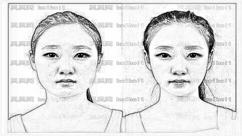 北京悦然整形医院怎么样?哪个医生技术好?,整形