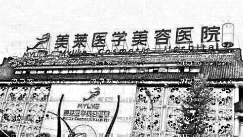 成都美莱做双眼皮开眼角怎么样?成都美莱做双眼皮开眼角介绍,医院选择很重要!