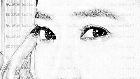韩式微创去眼袋怎么样?微创去眼袋怎么样?眼袋没有了!