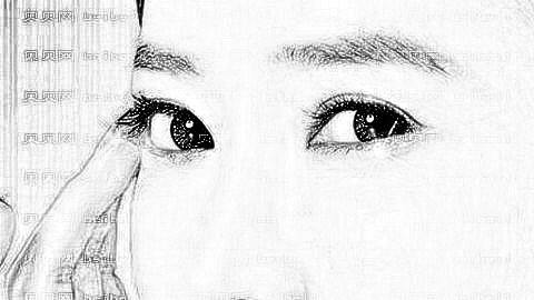 佛山大医美去眼袋怎么样?佛山大医美整形怎么样?整形果好!