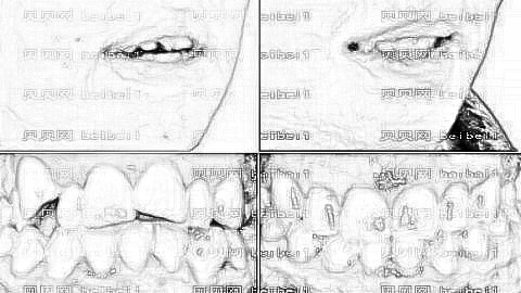 厦门齿度口腔医院怎么样?医生排名名单