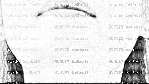 银川做下颌角厉害的医生哪个好?银川下颌角手术医生排名名单