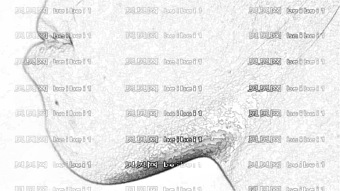 乌鲁木齐做下颌角厉害的医生哪个好?乌鲁木齐下颌角手术医生排名名单