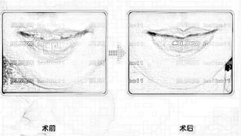 上海美仑整形医院怎么样?医生团队+整形价格