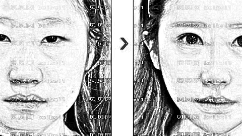 杭州昕微整形医院怎么样?医生团队+整形价格