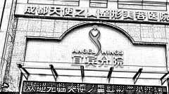 天使之翼去眼袋怎么样?天使之翼外切眼袋介绍及