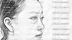 王海平去眼袋怎么样?王海平祛眼袋介绍,大眼很精致!