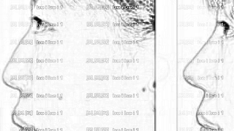 临沂美莱坞整形医院怎么样?医生团队+整形价格