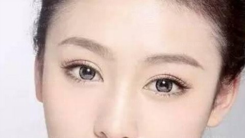 西安高一生做眼部手术怎么样?西安高一生做眼部手术介绍,很期待!