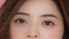成都华美紫馨开眼角怎么样?成都华美紫馨开眼角介绍及