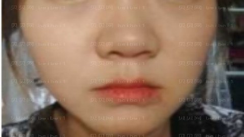昆明隆鼻哪个医生好?昆明隆鼻医生介绍名单名单
