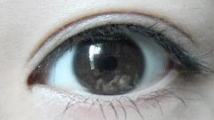 李寅做眼部手术怎么样?李寅做眼部手术介绍,很有实力!
