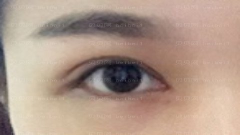 李寅做眼部手术怎么样?李寅做眼部手术介绍,很有实力!