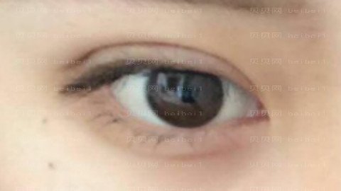 双燕医院做眼部手术怎么样?双燕医院做眼部手术介绍及