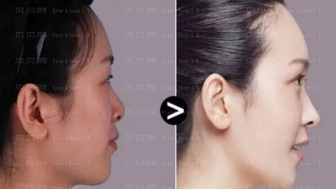 赣州华美整形医院怎么样?医生团队+整形价格