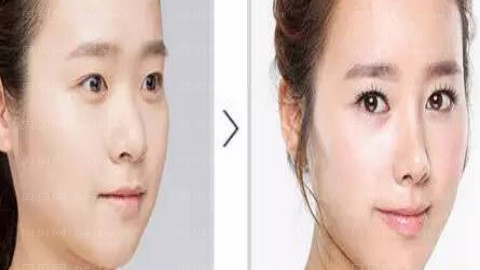 杭州冰美整形医院怎么样?医生团队+整形价格