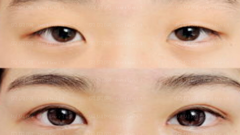杭州悦可整形医院怎么样?医生团队+整形价格